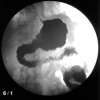 A monohierarchical multiaxial classification code for medical images in content-based retrieval