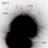 Activity Analysis in Microtubule Videos by Mixture of Hidden Markov Models