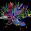 DTI Fiber Clustering in the Whole Brain