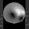 EEG Cortical Imaging: A Vector Field Approach for Laplacian Denoising and Missing Data Estimation