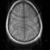 Fast regularized reconstruction of non-uniformly subsampled parallel MRI data