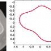 Implicitization of parametric curves by matrix annihilation