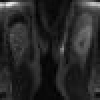 Integrated registration of dynamic renal perfusion MR images