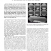 Long Bone Panoramas from Fluoroscopic X-ray Images
