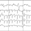 Nonlinear classification of EEG data for seizure detection