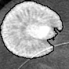 Shape Prior Criterion Based On Tchebichef Moments In Variational Region Growing