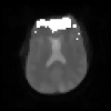 Solving for Motion and Activation Simultaneously in an fMRI Experiment with Multiple Stimulus Conditions