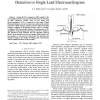 Support Vector Machine for Cardiac Beat Detection in Single Lead Electrocardiogram
