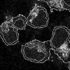 Topology preserving STACS segmentation of protein subcellular location images